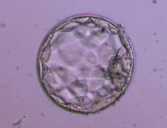 Expanded blastocyst.
